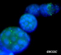 An image from the InCell Analyzer showing the Autophagy LC3 protein in GFP and DAPI in blue.